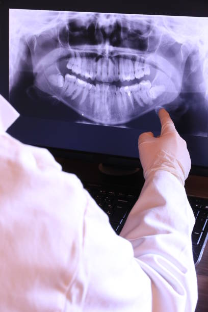 Best Emergency Root Canal Treatment in Maysville, OK