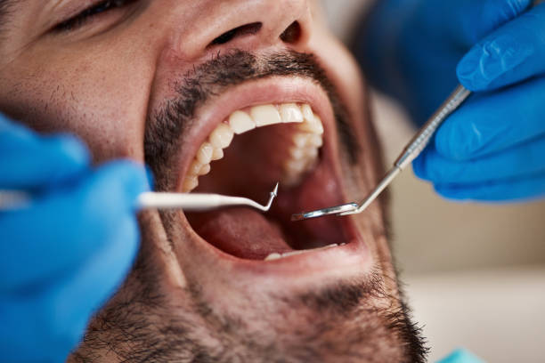 Best Emergency Dental Care for Abscessed Tooth in Maysville, OK